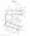 Fig. 04 - MOVEMENT ASSIST DEVICE