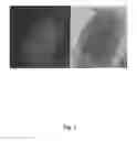 Fig. 02 - Method for culturing avian gonocytes