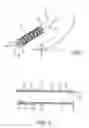 Fig. 02 - Stented vascular graft