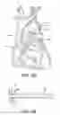 Fig. 07 - Stented vascular graft