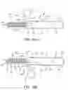 Fig. 08 - Stented vascular graft