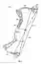 Fig. 09 - Riser for a bow