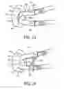 Fig. 08 - RESPIRATORY PATIENT INTERFACE DEVICE AND HEADGEAR CONNECTION APPARATUS