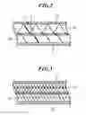 Fig. 03 - ULTRASONIC CLEANING DEVICE