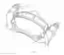 Fig. 12 - Dampening clip