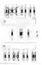 Fig. 15 - Transport system and transport method