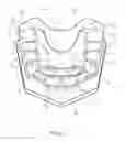 Fig. 02 - Orthodontic appliances for correcting teeth irregularities and for retaining the position of teeth