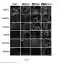 Fig. 03 - COMPOSITIONS AND METHODS FOR INCREASING THE EXPRESSION AND SIGNALLING OF PROTEINS ON CELL SURFACES