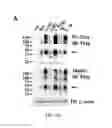Fig. 05 - COMPOSITIONS AND METHODS FOR INCREASING THE EXPRESSION AND SIGNALLING OF PROTEINS ON CELL SURFACES