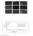 Fig. 06 - Curcumin derivatives for amyloid-β plaque imaging