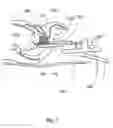 Fig. 02 - ELASTOGRAPHY-BASED ASSESSMENT OF CRYOABLATION