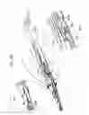 Fig. 04 - Apparatus and method for electrosurgical suction with finger actuated suction control