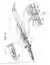 Fig. 07 - Apparatus and method for electrosurgical suction with finger actuated suction control