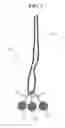 Fig. 05 - Self-assembling suture anchor assembly, surgical kit, and surgical repair method