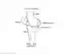 Fig. 02 - Implant for restoring normal range flexion and kinematics of the knee