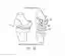 Fig. 03 - Implant for restoring normal range flexion and kinematics of the knee