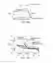 Fig. 19 - Implant for restoring normal range flexion and kinematics of the knee