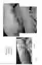 Fig. 37 - METHOD FOR ENHANCING TUMOR GROWTH