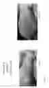 Fig. 49 - METHOD FOR ENHANCING TUMOR GROWTH