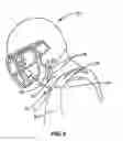 Fig. 07 - Neck protection device