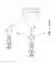 Fig. 02 - Variable rigidity tow cable