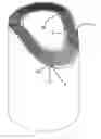 Fig. 01 - Device suitable for treatment of a fluid as well as a method and machine suitable for the manufacture of such a device