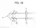 Fig. 16 - Ophthalmologic image processing apparatus