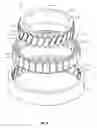Fig. 03 - METHODS OF OPERATING ROLLER BEARING APPARATUSES INCLUDING COMPLIANT ROLLING ELEMENTS