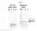 Fig. 06 - Conversion of alpha-hydroxyalkylated residues in biomolecules using methyltransferases