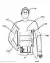 Fig. 01 - Arm Restricting Bandage