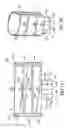 Fig. 02 - Arm Restricting Bandage