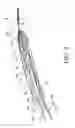 Fig. 06 - Systems and methods for positioning and compacting a bodily implant