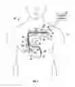 Fig. 02 - Labeled implantable medical devices