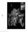 Fig. 08 - Rodent comprising mouse artificial chromosome vector