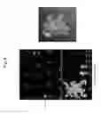 Fig. 09 - Rodent comprising mouse artificial chromosome vector