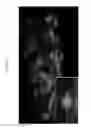 Fig. 22 - Rodent comprising mouse artificial chromosome vector