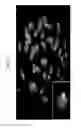 Fig. 32 - Rodent comprising mouse artificial chromosome vector
