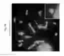 Fig. 79 - Rodent comprising mouse artificial chromosome vector