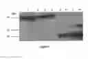 Fig. 07 - Expression of the human IGF-1 in transgenic plastids
