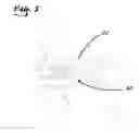 Fig. 06 - Aircraft tie-down device