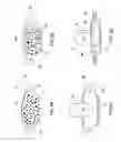 Fig. 08 - BRAKE PAD ASSMBLY AND METHOD FOR COLLECTING BRAKE PARTICLES