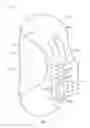 Fig. 07 - 3-layer “C” shaped side airbag