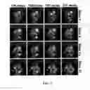 Fig. 08 - Methods and apparatus for reducing scan time of phase contrast MRI