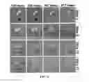 Fig. 09 - Methods and apparatus for reducing scan time of phase contrast MRI