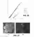 Fig. 20 - Corrosion detection in structural tendons