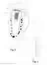 Fig. 03 - ENDOSSEOUS IMPLANT AND METHOD FOR PRODUCTION THEREOF