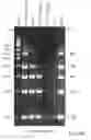 Fig. 40 - Nucleic acid amplification primers for PCR-based clonality studies