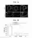 Fig. 02 - Intermittent dosing regimen for treating breast cancer