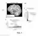 Fig. 08 - Methods and Systems To Identify Phase-Locked High-Frequency Oscillations In The Brain