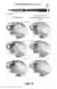 Fig. 09 - Methods and Systems To Identify Phase-Locked High-Frequency Oscillations In The Brain